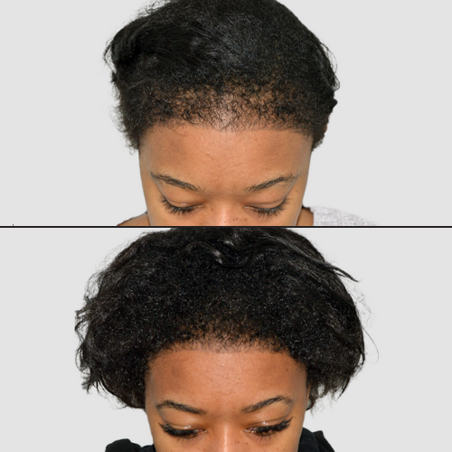 Batana Natural Hair Growth