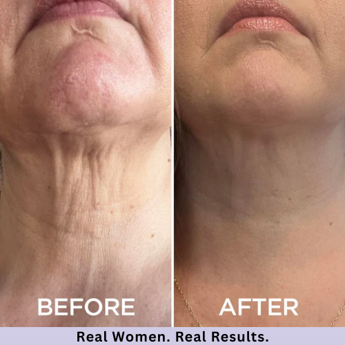 Tighten & Lift Neck Cream