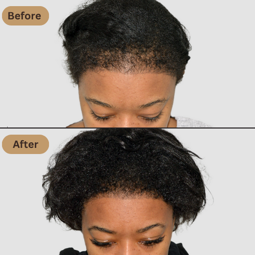 Batana Natural Hair Growth Shampoo